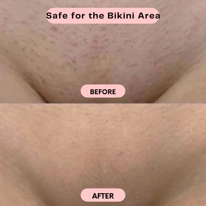 2 IN 1 Painless Bikini Shaver