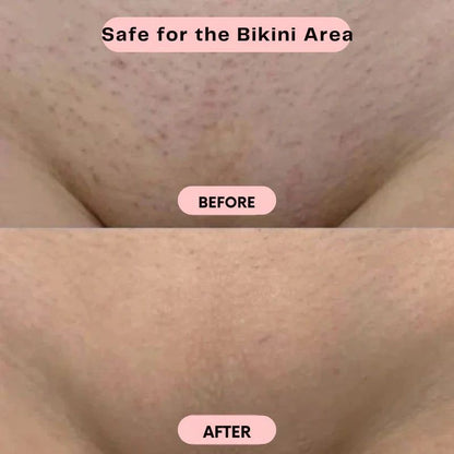 2 IN 1 Painless Bikini Shaver