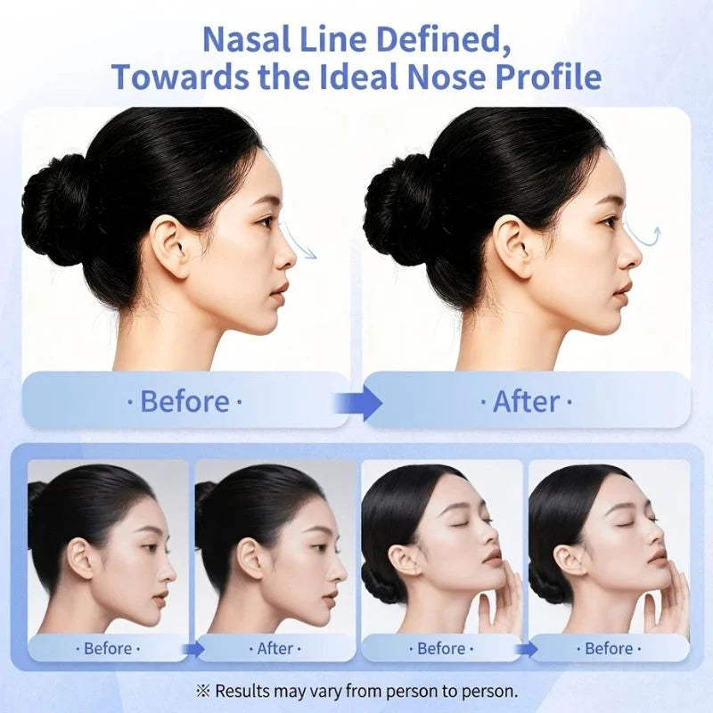 EMS Nose Lift & Beauty Device