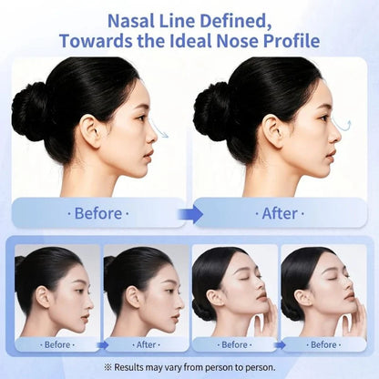 EMS Nose Lift & Beauty Device